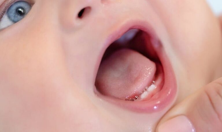 How Long It Takes For A Baby Tooth To Emerge