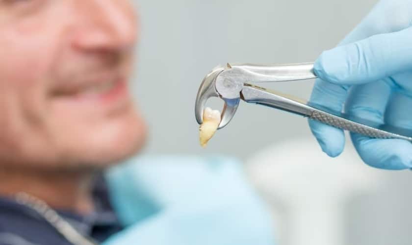 What To Eat After Tooth Extraction For Quick Healing