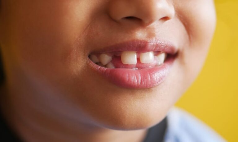 Kids Loose Tooth
