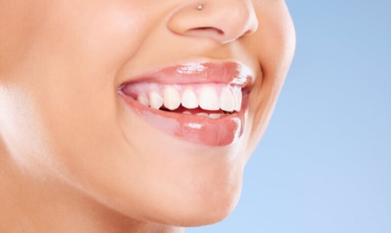 Best Instant Teeth Whitening Options