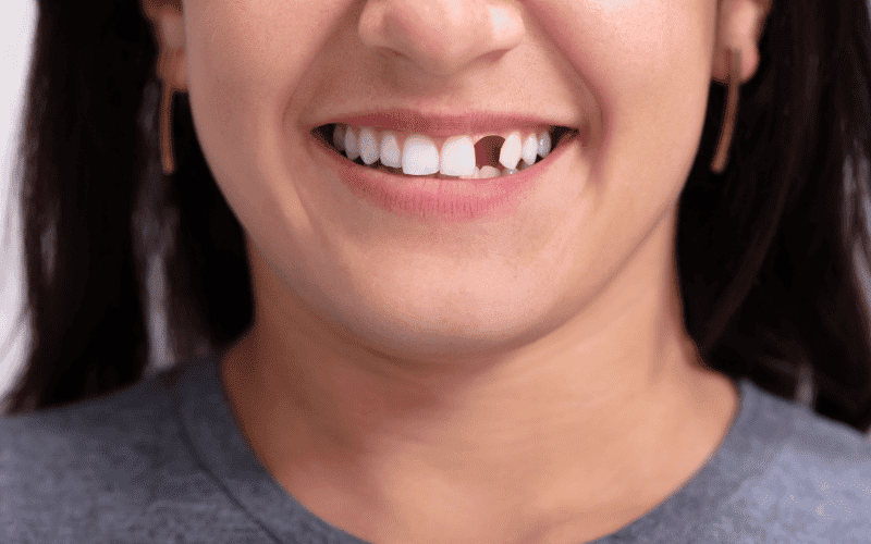 Restorative Dentistry
