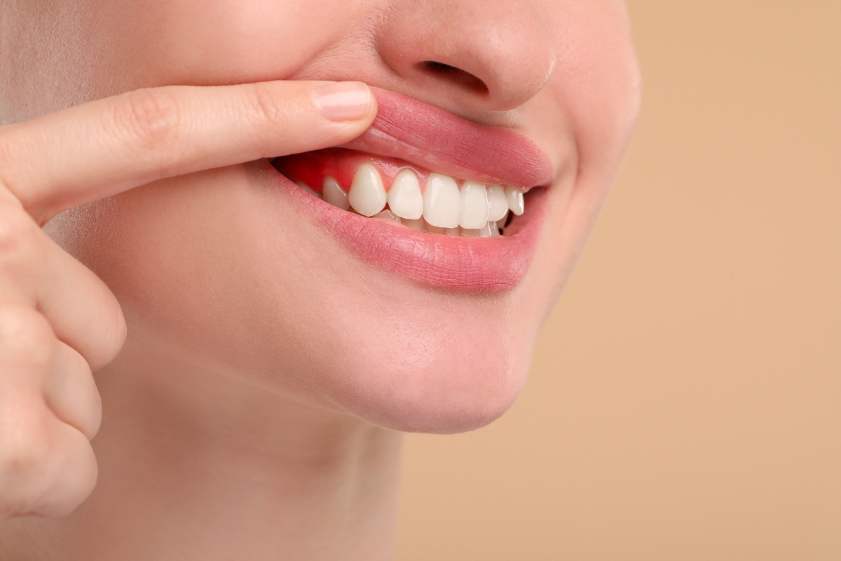 Gum-Disease-Treatment-Solutions-In-Cypress